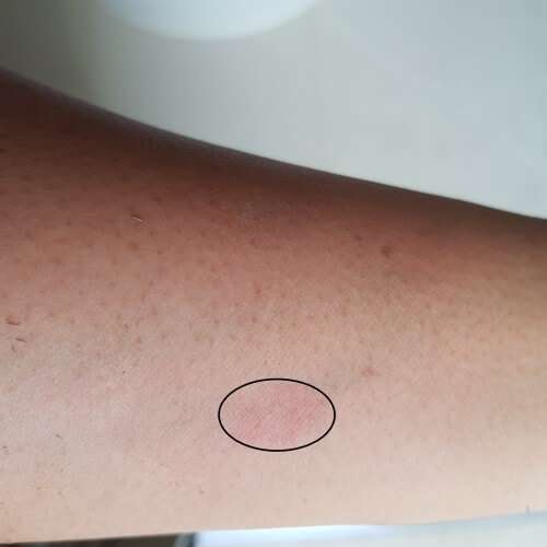 lipstick remains on forearm