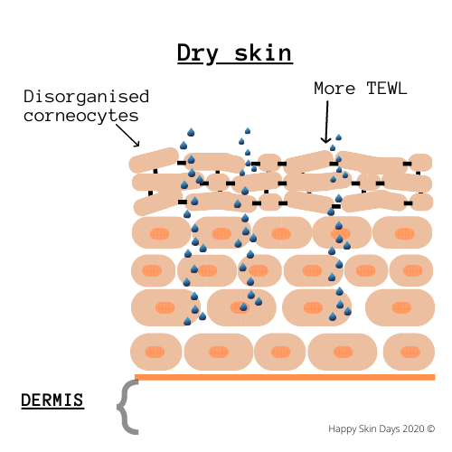 photo of dry skin